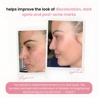 TurboGlow Pads — Entfache deinen strahlenden Teint und verabschiede dich für immer von dunklen Flecken!
