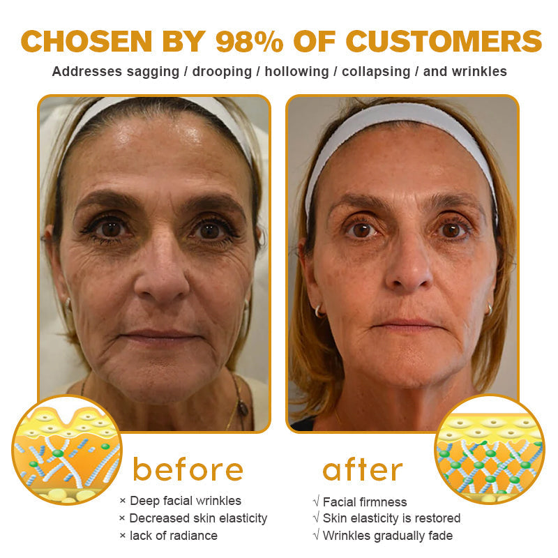 SkinCommand™ PowerLift Creme — Sofort straffere, prallere Haut, die dich jung und unwiderstehlich macht