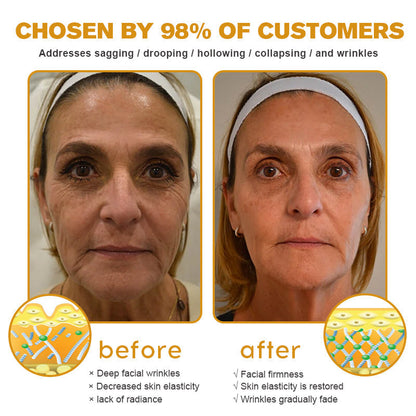 SkinCommand™ PowerLift Creme — Sofort straffere, prallere Haut, die dich jung und unwiderstehlich macht