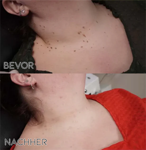 SkinReboot™ — Endlich schmerzfrei zu strahlend makelloser Haut, die jede Aufmerksamkeit verdient!
