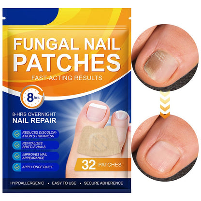 FungiGuard™ — Endlich klare Nägel und wieder selbstbewusst auftreten!