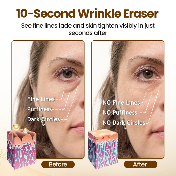 VitaLift 10s Serum — Straffe, strahlende Haut in Sekunden – fühl dich wieder jugendlich und frisch!