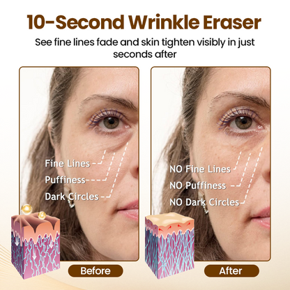 VitaLift 10s Serum — Straffe, strahlende Haut in Sekunden – fühl dich wieder jugendlich und frisch!
