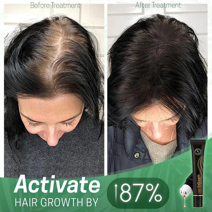 HairVibeX™ — Stärke und Glanz, die dein Haar zum Leben erwecken
