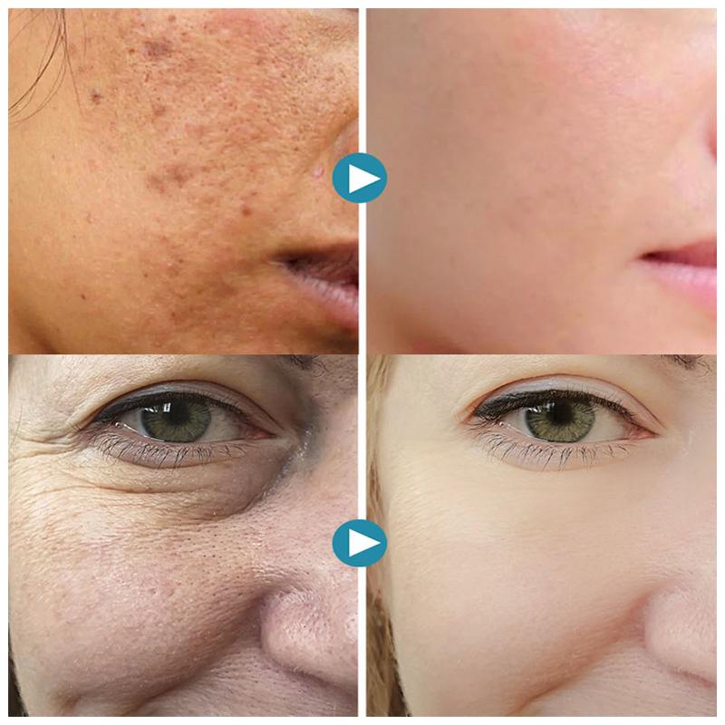 VeraSilk — Entfessle den seidigen Glow für makellos glatte Haut, die alle Blicke fesselt!