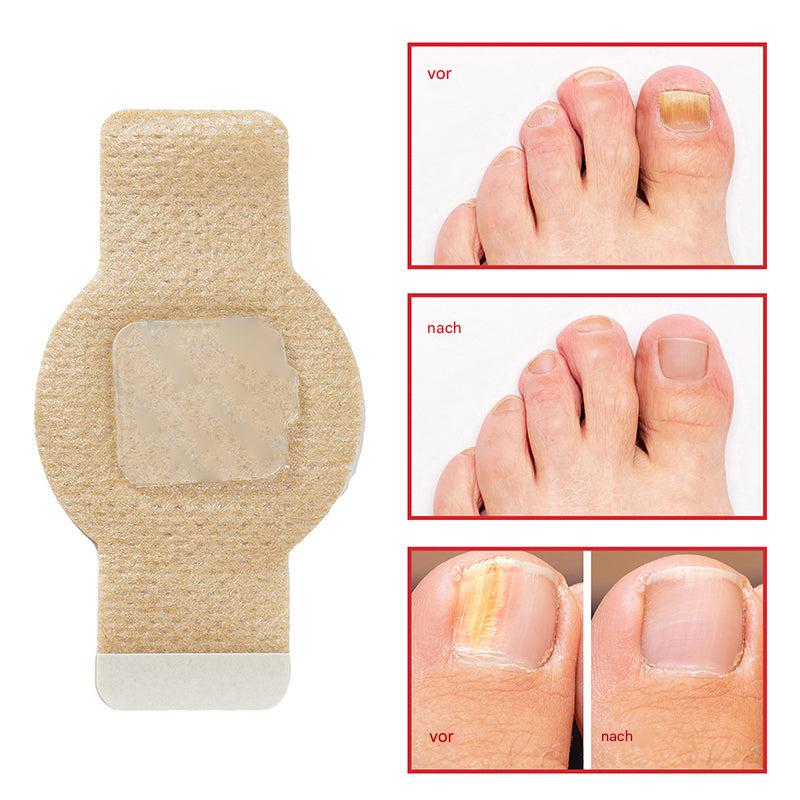 RéVoyal™ — Strahle mit makellosen Nägeln und neuer Selbstsicherheit jeden Tag