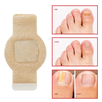 RéVoyal™ — Strahle mit makellosen Nägeln und neuer Selbstsicherheit jeden Tag