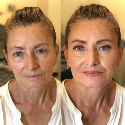 SkinFire Boost™ — Verjünge Deine Haut sofort mit strahlender Frische und makelloser Leichtigkeit