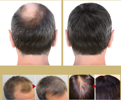 FireRoots — Entfessele volles, kraftvolles Haar, das alle Blicke fesselt!