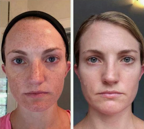 Goldstaub Serum — Entfessle Deinen Strahlend-Jungen Teint Ohne Kompromisse