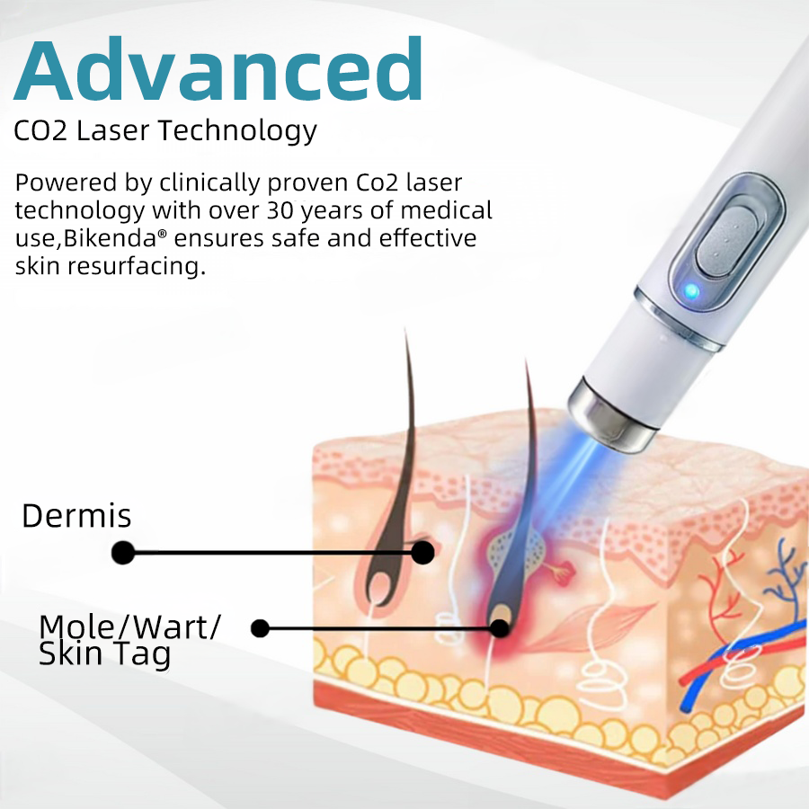 ClearSkinPro™ — Schmerzfrei zu makelloser Haut, die jeden Spiegel zum Freund macht
