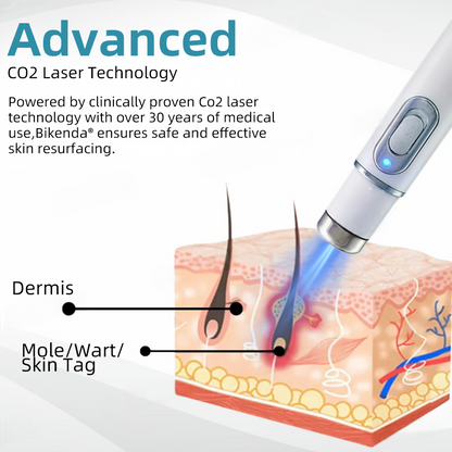 ClearSkinPro™ — Schmerzfrei zu makelloser Haut, die jeden Spiegel zum Freund macht
