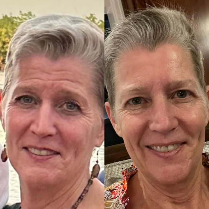 GlowArmor™ — Wach auf mit sichtbar glatter Haut und jugendlichem Strahlen