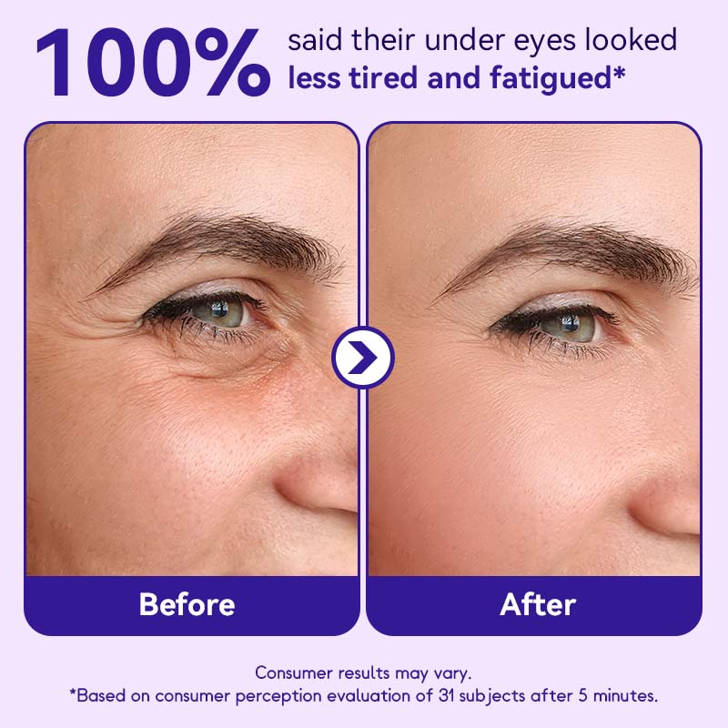 FlashGlow Eye Serum — Entfalte strahlende Jugendlichkeit und verabschiede müde Augen in nur 5 Minuten!