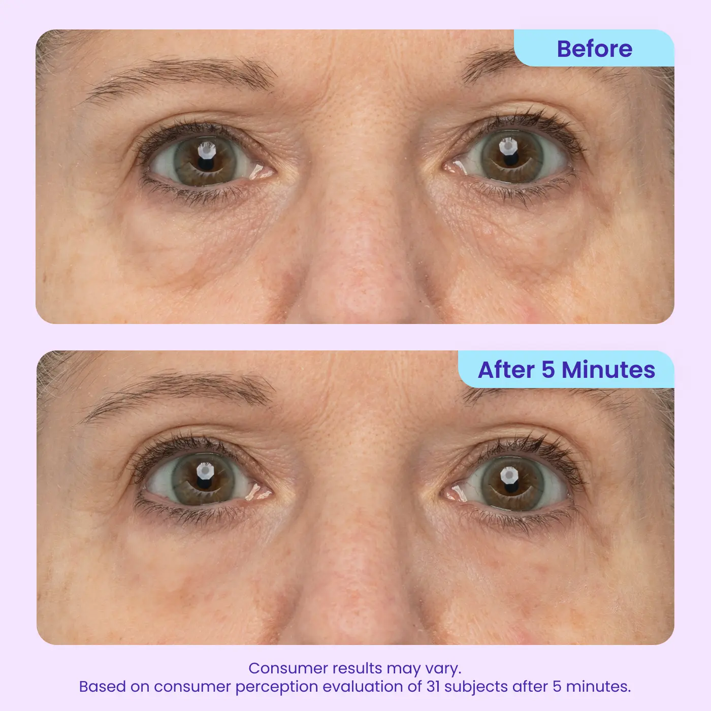 FlashGlow Eye Serum — Entfalte strahlende Jugendlichkeit und verabschiede müde Augen in nur 5 Minuten!